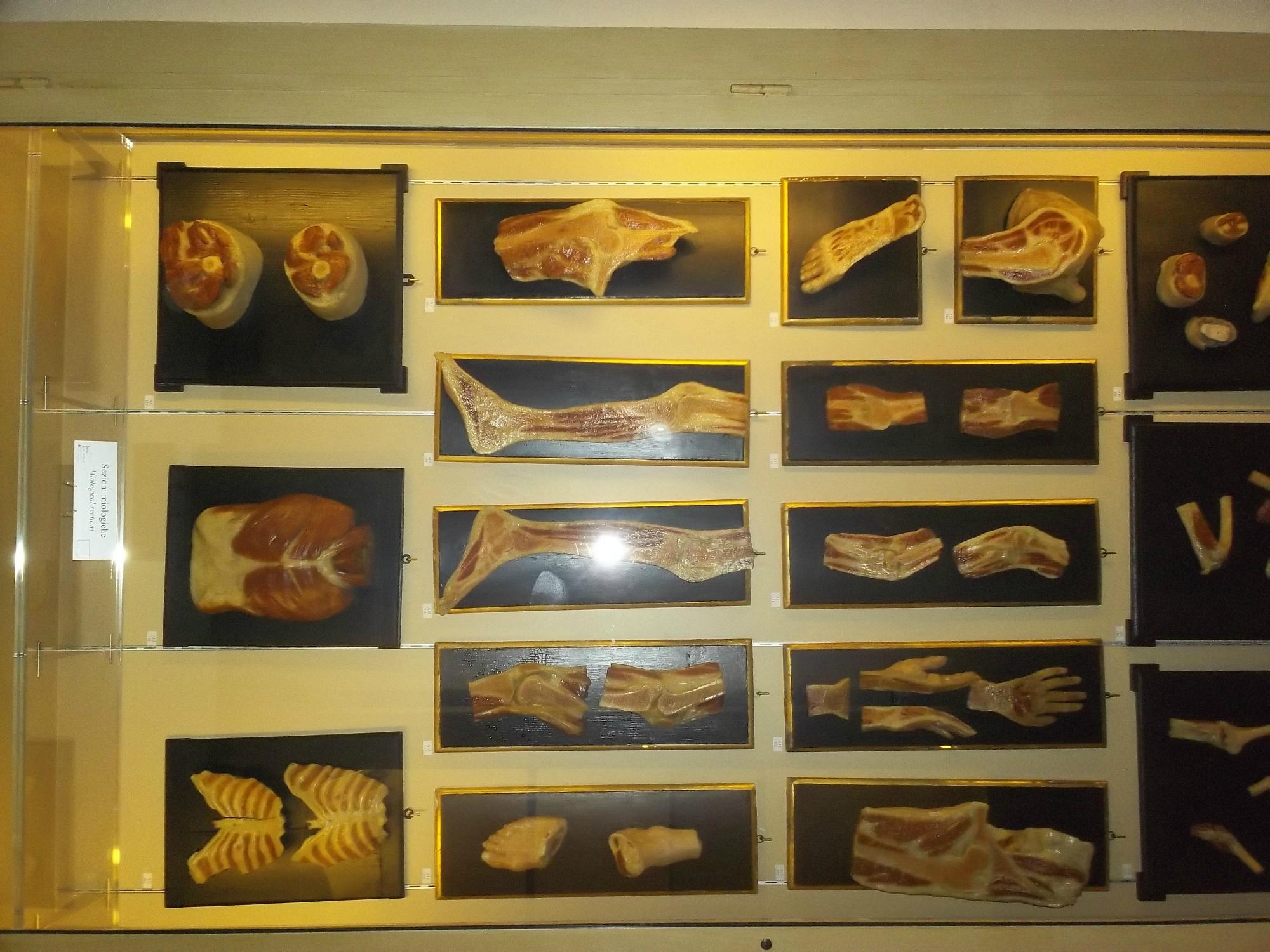 Museo Delle Cere Anatomiche